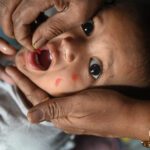 أسوأ تفشي في 30 عامًا.. كيف ضربت الحصبة أوروبا؟ - برفيلكس - brieflex