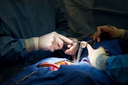 إنجاز طبي في الصين.. نجاح أول عملية زرع كلية خنزير معدلة وراثيًا لإنسان