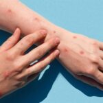 الأمراض السبعة الأكثر إيلامًا والتي تؤدي إلى الموت - برفيلكس - brieflex