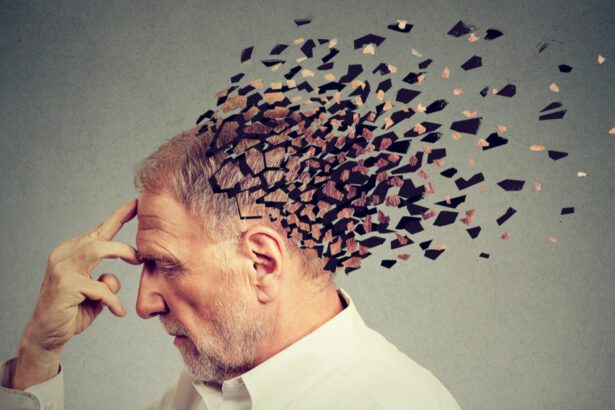  - برفيلكس - brieflex