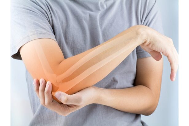  - برفيلكس - brieflex