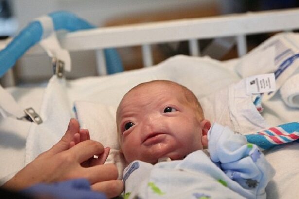  - برفيلكس - brieflex